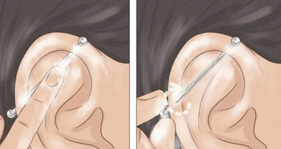 Comment bien nettoyer un piercing industriel ?