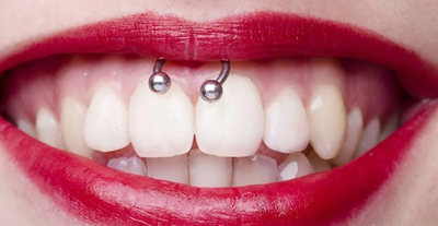 Est-ce que le piercing smiley fait mal ?